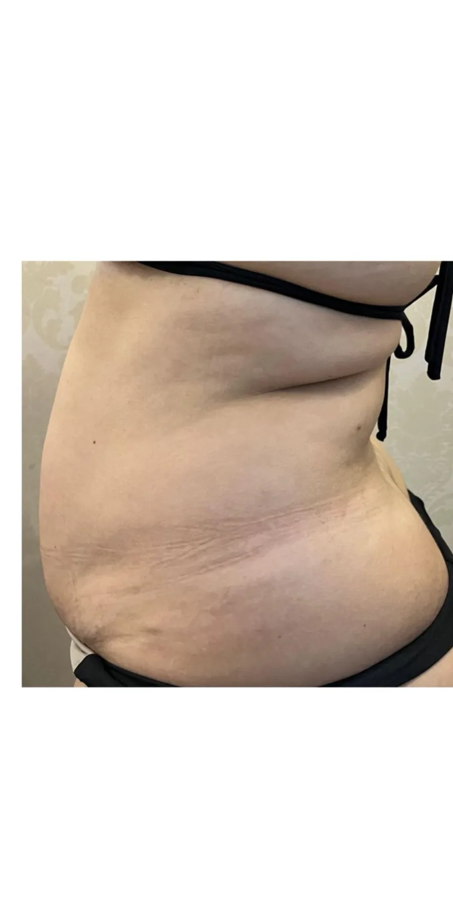 Asian Body Method, antes