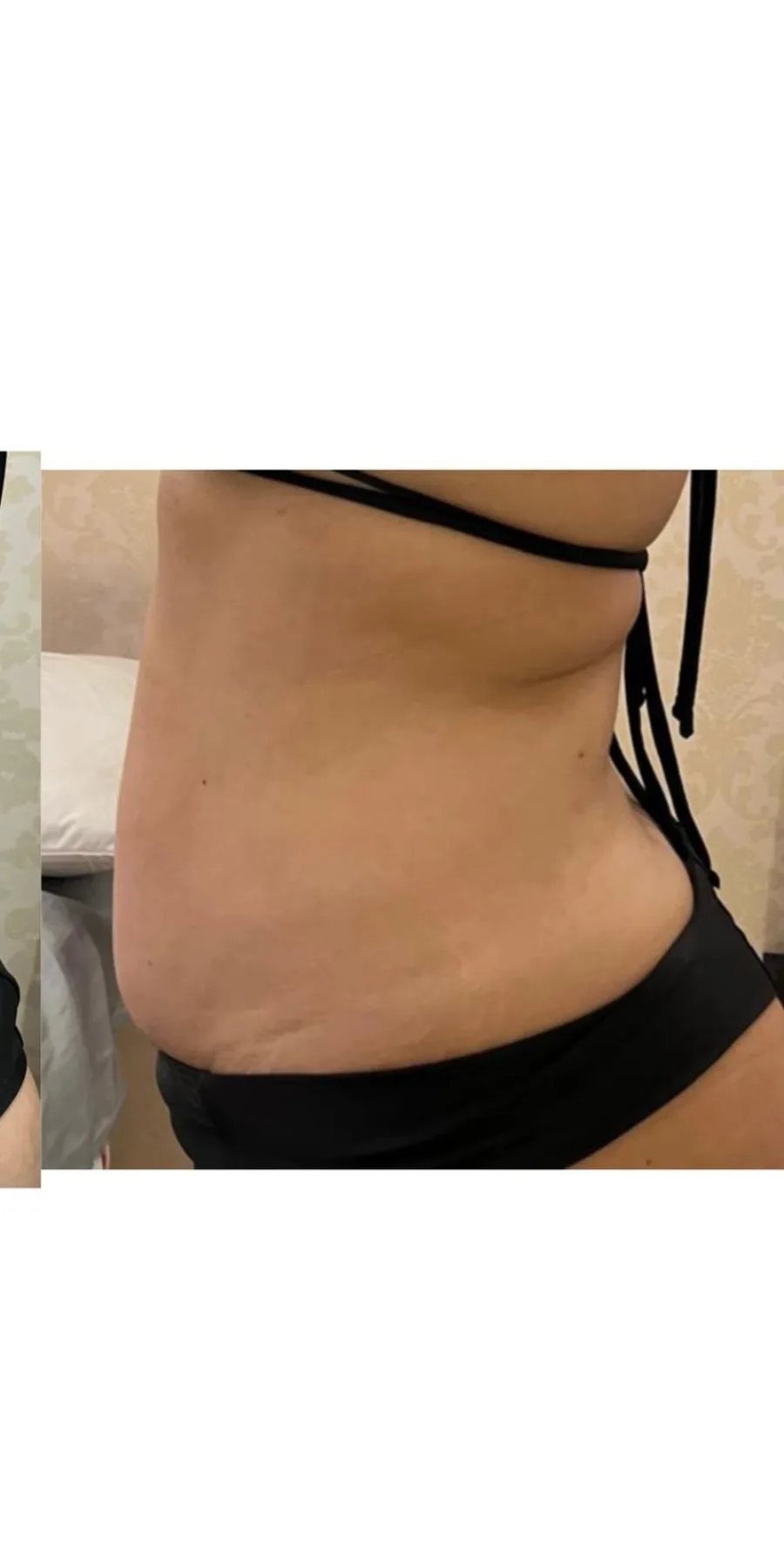 Asian Body Method, depois