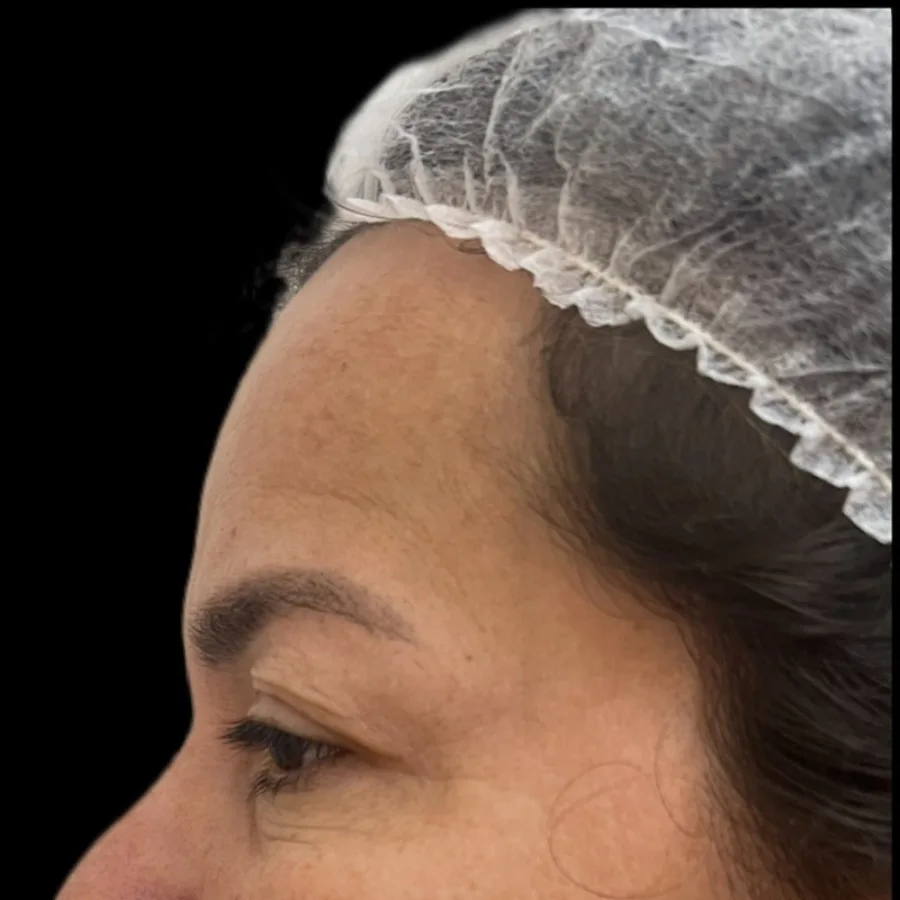 Asian Face Method, antes