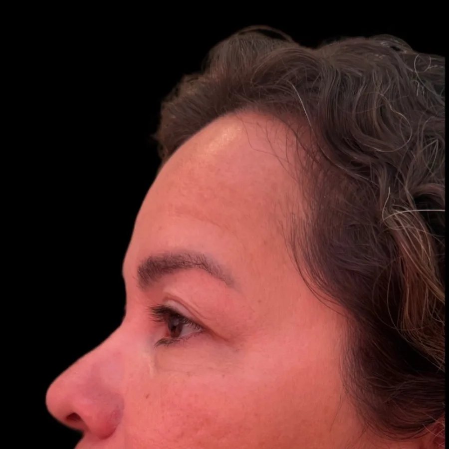 Asian Face Method, depois