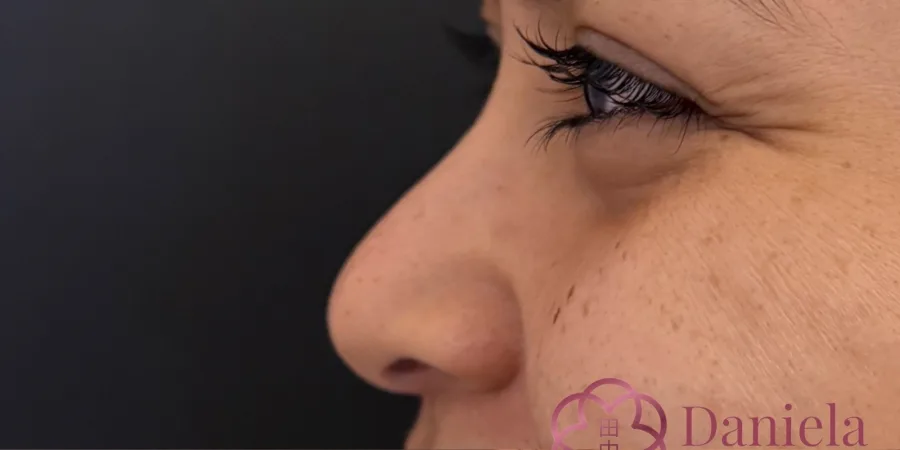 Full Face do Poder, antes