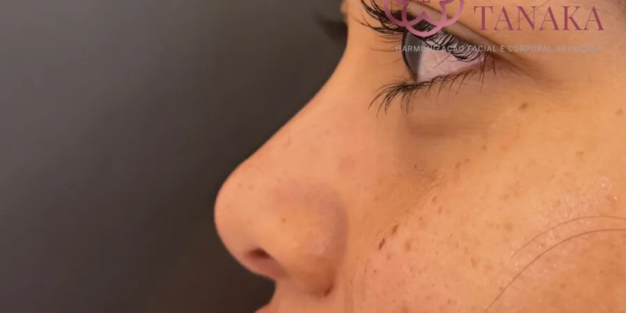 Full Face do Poder, depois